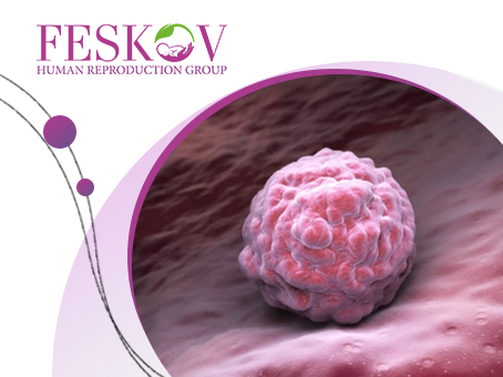 Preparazione endometriale per il trasferimento di embrioni: come funziona - Centro di donazione e Maternità surrogata clinica del professor Feskov A.M.